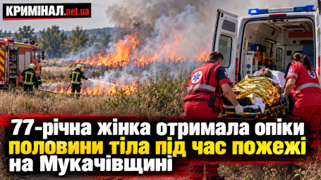 77-річна жінка отримала опіки половини тіла під час пожежі на Мукачівщині