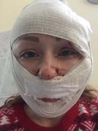 В Турции ревнивый муж порезал лицо украинке