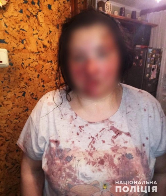 В Киевской области мужчина избил знакомую и угрожал убийством