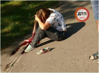 В Киеве на Теремках сильно избили девушку