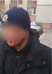 В Луцке полицейский пострадал от действий неуравновешенного мужчины
