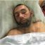 В Одессе устанавливается личность мужчины, получившего серьезную травму