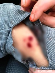 В Киевской области мужчина получил огнестрельное ранение