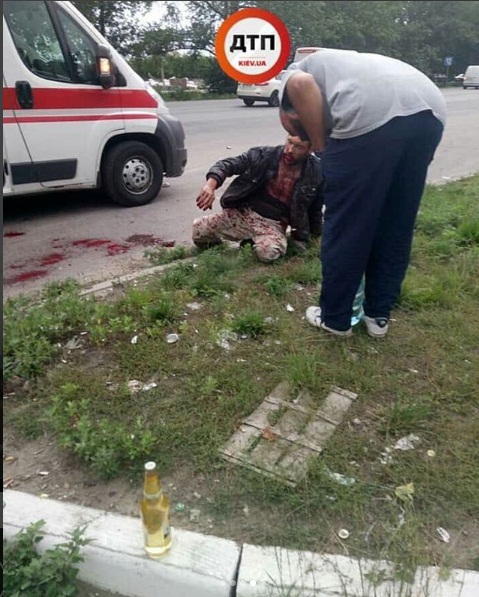 В Киеве найден окровавленный мужчина с серьезными телесными повреждениями