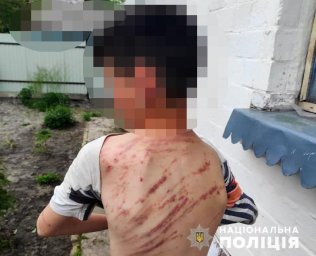 В Волынской области мужчина избил малолетнего пасынка