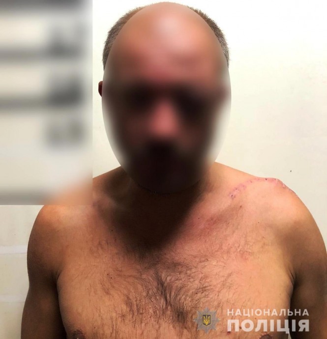В Вышгороде мужчина пытался убить мужа своей бывшей жены