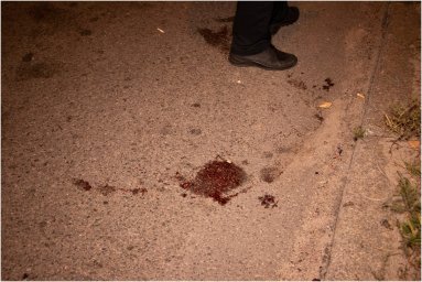 В Киеве на улице Академика Заболотного авто на российских номерах сбило мужчину
