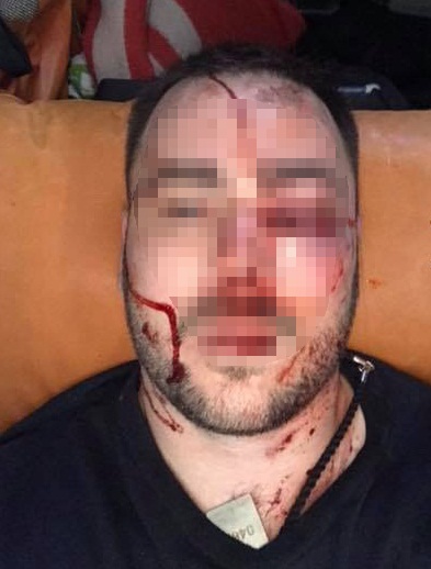 В Запорожье совершено жестокое вооруженное нападение на лидера «АвтоЕвроСилы»
