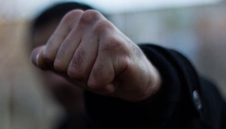 В Одесі нападник побив посадовця міськради