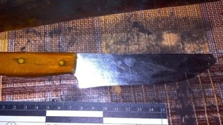 У Франківську під час застілля чоловік ударив знайомого ножем у живіт У Франківську під час застілля чоловік ударив знайомого ножем у живіт