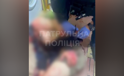У Запоріжжі чоловік підірвався на гранаті: патрульні врятували йому життя